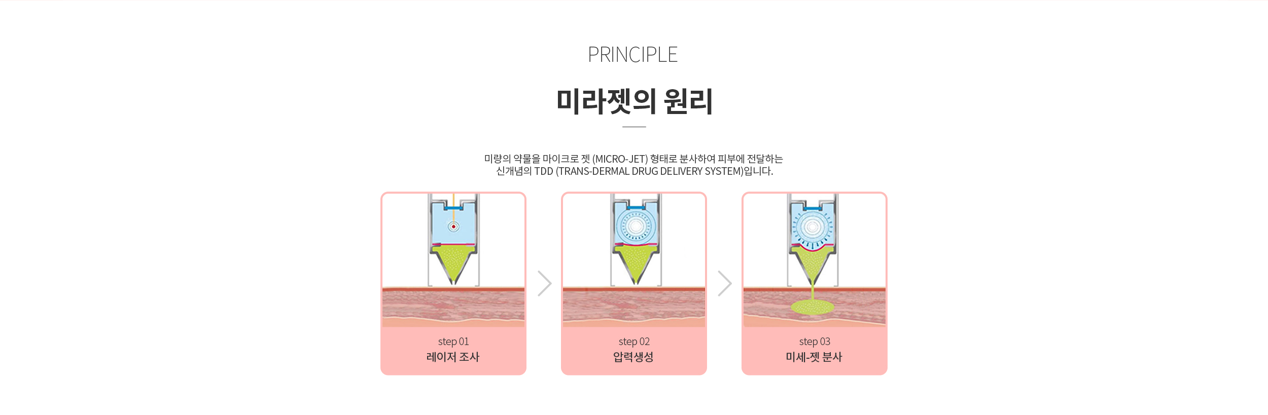 미라젯의 원리